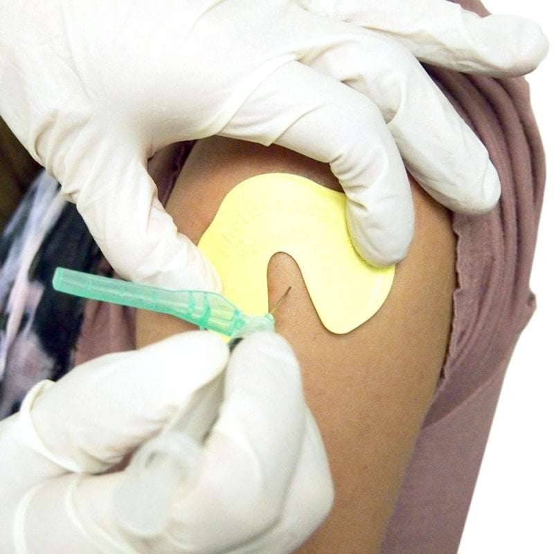 A medical professional is administering an injection to a patient using an yellow ShotBlocker device, which is designed to reduce pain associated with injections.