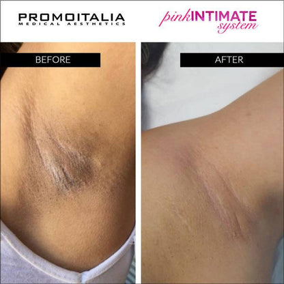 Intimní systém Promoitalia Pink